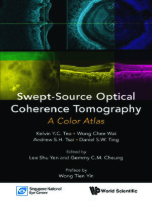 cover image of Swept-source Optical Coherence Tomography